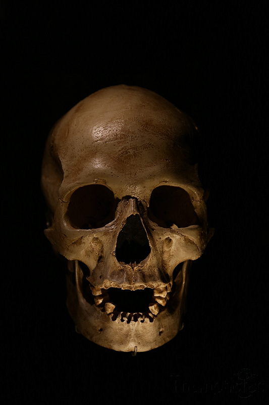 reportage photo été 2021 france eurodisney mickey paris disney disneyland musée de l'Homme squelette skeleton trépanation head skull crâne